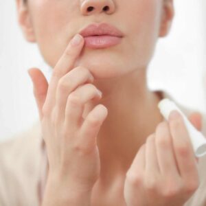 Lip lift en Vitoria 4 Sarabia post 3