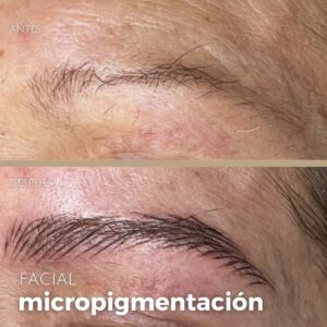 Dermopigmentación 20 1311