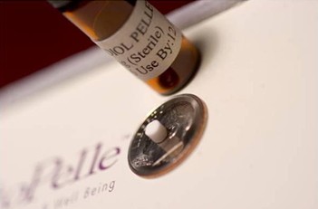 Terapia Sottopelle en bilbao-precio